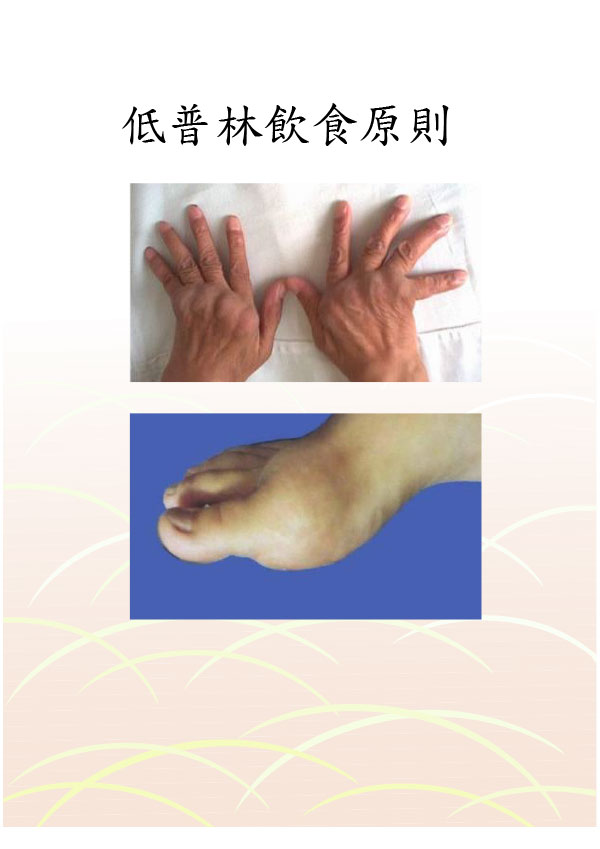 低普林飲食原則